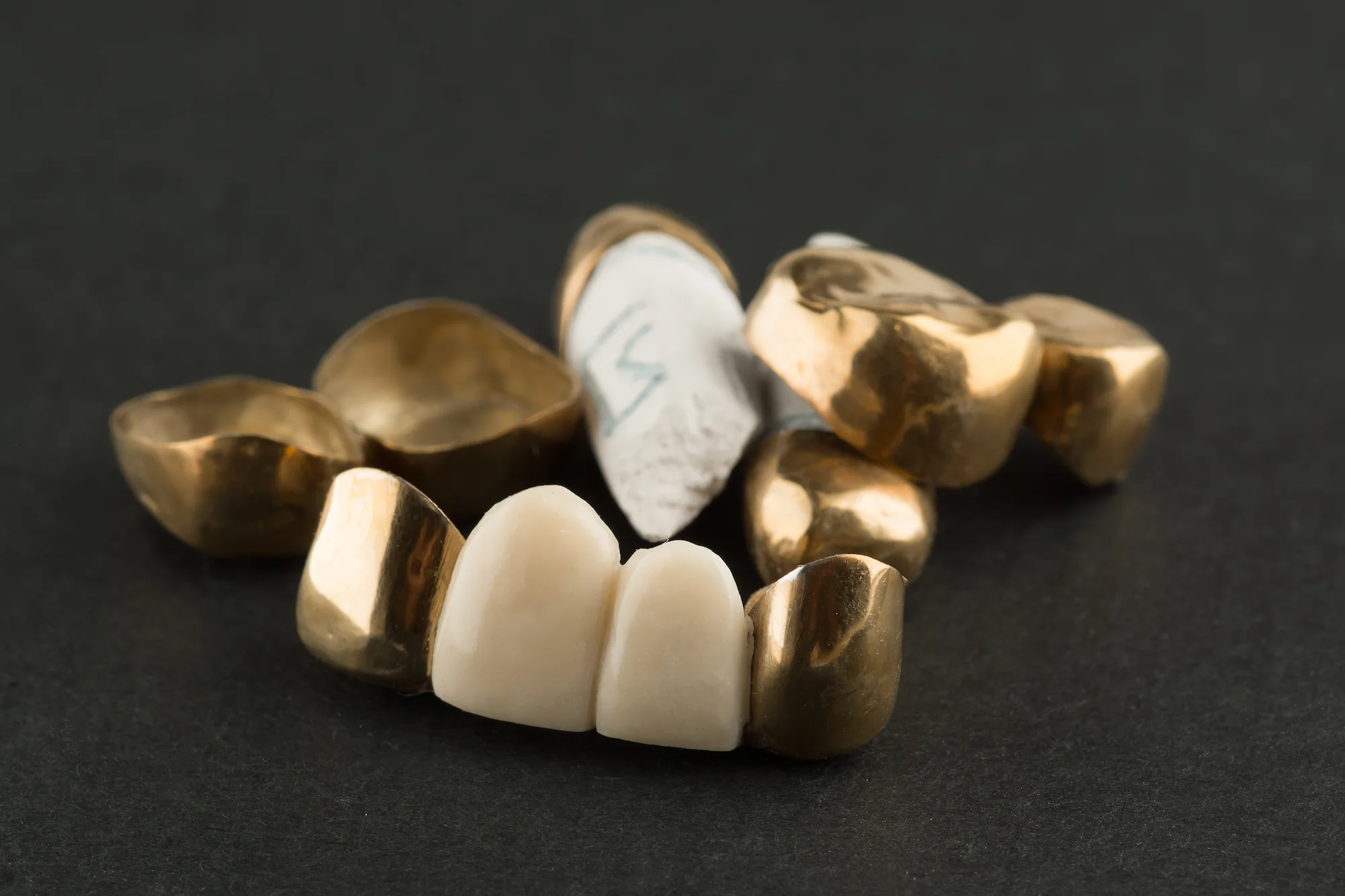Dental Gold Pieces